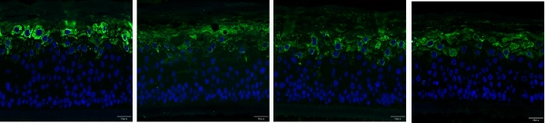 SLS-induced damaged 3D skin model