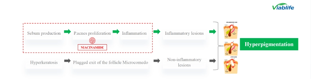 Nicotinamide in Acne Management